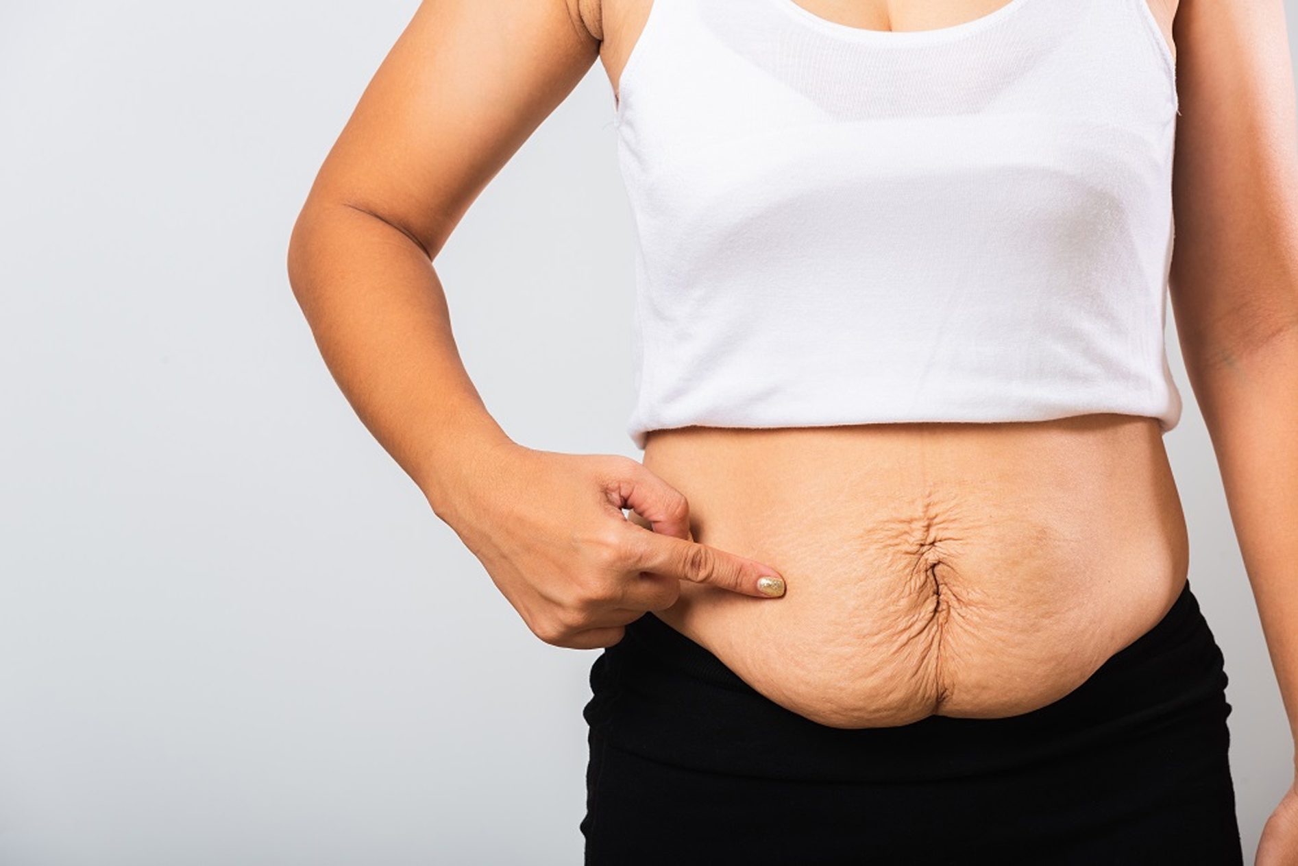 Gastric Bypass vs Gastric Sleeve