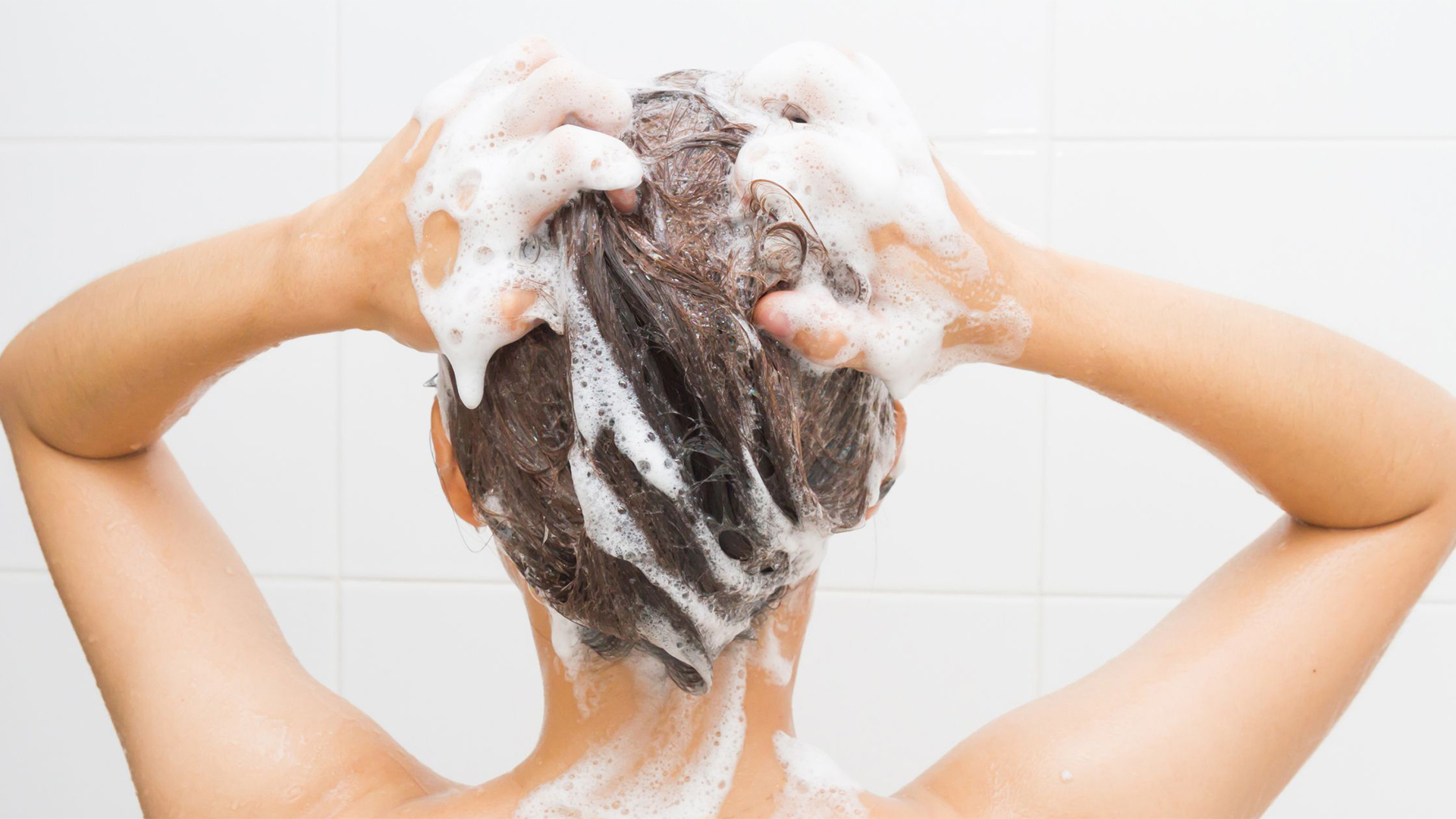 hair transplant