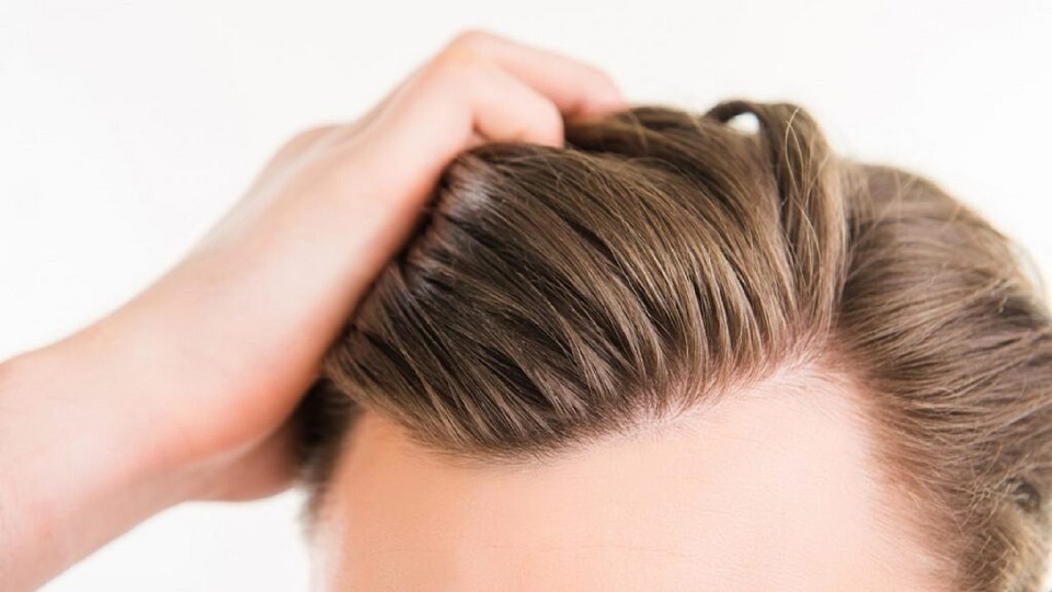 Hair Transplant