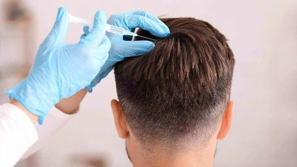 Hair Transplantation