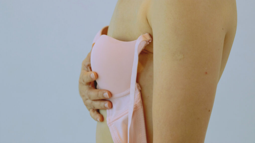 prosthetic materials